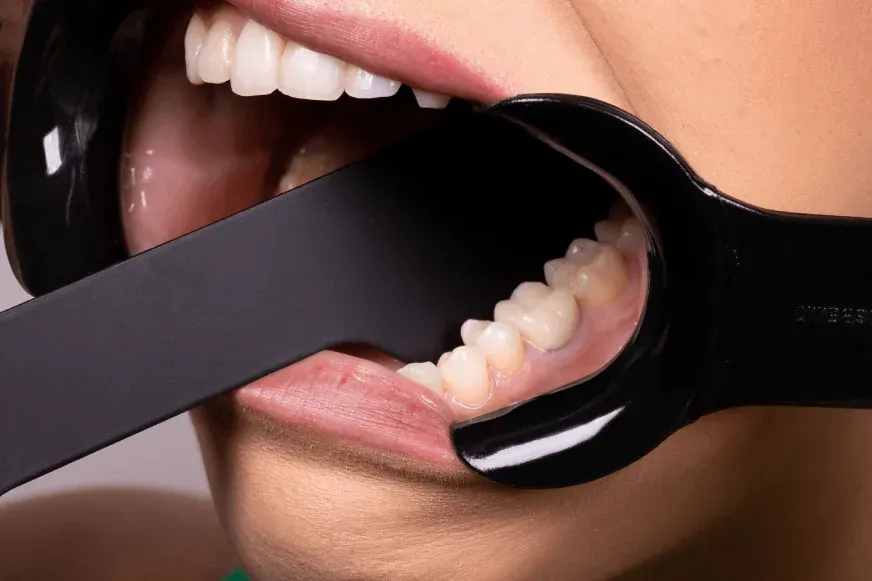 Afastador Labial C – Infantil, foto 4 de 4