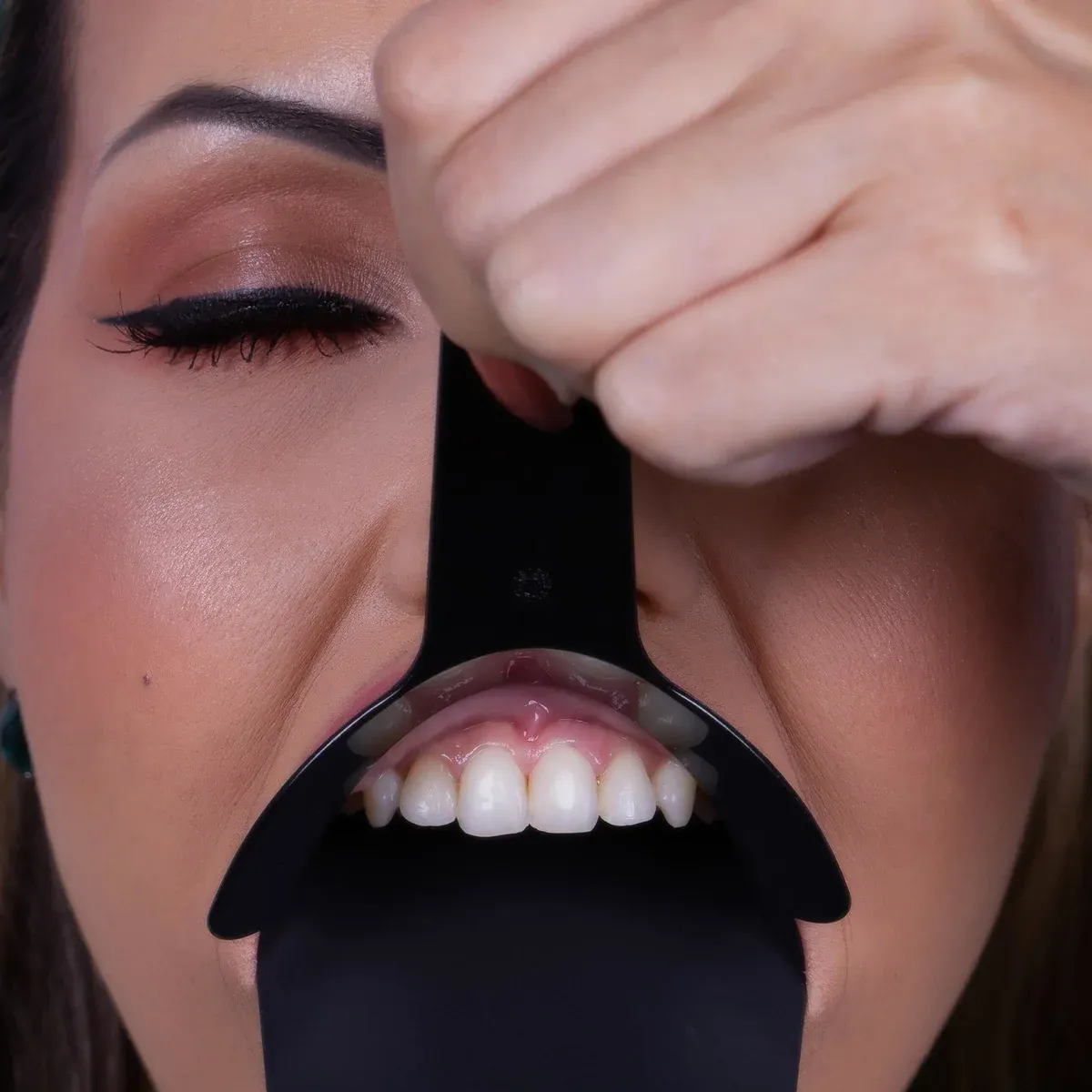 Cheek Retractors MF Model, photo 4 of 4