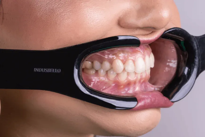 Pediatric Cheek Retractors V2-Shape, photo 4 of 4