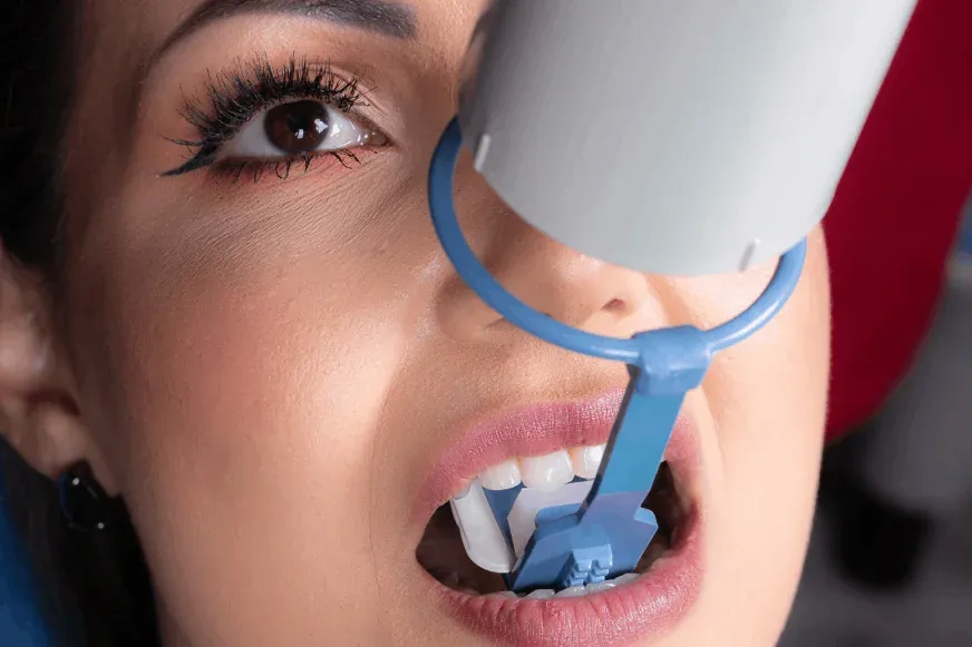 Posicionador Radiográfico Cone Indicator para Dentes Anteriores, foto 2 de 2